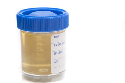 where can i get a bottle tested for urine|urine sample bottles at boots.